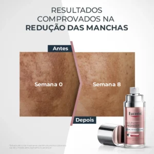 Eucerin Dual Sérum Facial AntiManchas e Anti-idade 30ml Anti-Pigment Clareador Thiamidol Ácido Hialurônico - Imagem 5