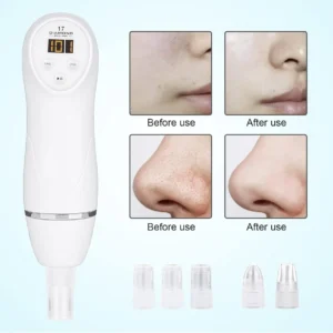 Peeling Diamante Dermoabrasão Sucção Remover Cravos Espinhas - Imagem 6