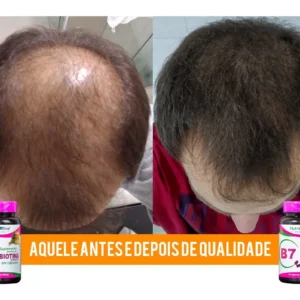 Remédio Anti Queda Capilar E Cresce Cabelo Biotina 60 Capsul - Imagem 4