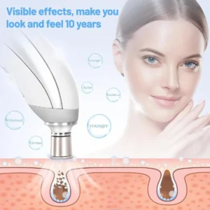 Peeling Diamante Dermoabrasão Sucção Remover Cravos Espinhas - Imagem 7