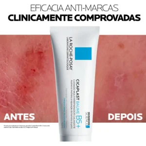 Creme Multirreparador Calmante Cicaplast Baume B5+ Para Todos Os Tipos De Pele Com 40ml La Roche Posay - Imagem 4