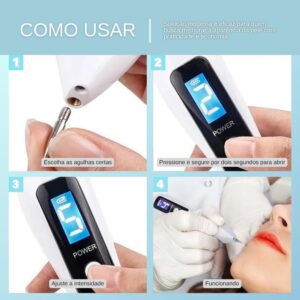 Caneta Elétrica Profissional para Remoção de Manchas, Display Digital LED, Tecnologia Ion, USB Recarregável, com Agulhas, Uso Estético - Imagem 2