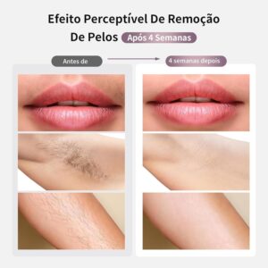 Depilador a Laser IPL MLAY T4 com Resfriamento, Aprovado pela ANVISA, Luz Pulsada para Uso Doméstico, Redução Visível de Pelos com Uso Contínuo, Unissex, para Rosto, Axilas e Corpo, Bivolt - Imagem 6