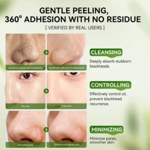 Lanbena 3.0 Máscara Facial Removedora De Cravos 30g Charcoal - Imagem 7