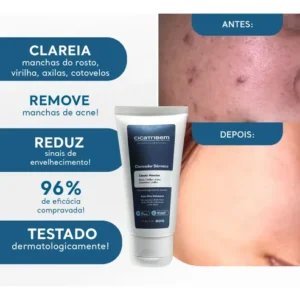 Clareador De Manchas P/ Axilas Virilha Melasma - Cicatribem - Imagem 4