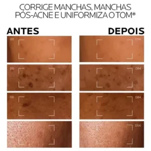 Sérum Antimanchas com Melasyl e Niacinamida para Todos os Tipos de Pele que Corrige Manchas Persistentes, Unifica o Tom e Ilumina, sem Perfume, Mela B3 La Roche‑Posay 15ml - Imagem 4