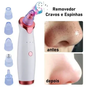 Removedor De Cravos Sugador Espinhas Poros Elétrico Peeling - Imagem 5
