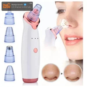 Removedor De Cravos Sugador Espinhas Poros Elétrico Peeling - Imagem 1
