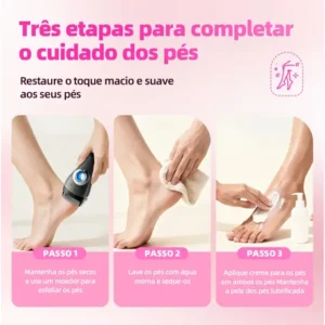 Momlulu M2 Lixador De Pés Elétrico Portátil Carregamento Usb - Imagem 7