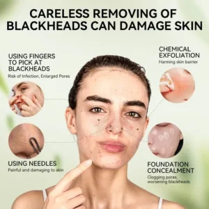 Lanbena 3.0 Máscara Facial Removedora De Cravos 30g Charcoal - Imagem 6