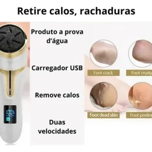 Lixa Elétrica Benedita MT 510 6W USB para Calos e Pedicure - Imagem 5