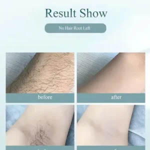 Depilador A Laser Luz Pulsada IPL Basike Sensacao Gelo Indolor Depilacao Definitiva 1 Milhao Disparos 9 Niveis Rosto Corpo aparelho depilacao feminino depilação a laser laser depilacao depilacao intim - Imagem 6