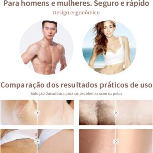 Depilador e Rejuvenescedor a Laser Permanente Luz Pulsada Lescolton T-009i - Imagem 6