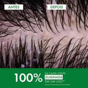 Shampoo Anticaspa Cabelos Secos com Selênio DS, Dercos DS Vichy, Refil 200g - Imagem 5