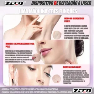 Depilador A Laser 990 Mil Pulsos 9 Marchas Três Modos Zcco - Imagem 5