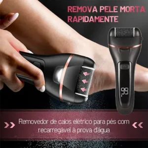 Kit 18 Lixador Para Pés Elétrico Esfoliante Removedor Calos - Imagem 3
