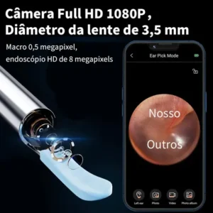 Otoscópio HD Digital com Câmera LED WI-FI para Ouvido, Nariz e Garganta + kit de Limpeza com Seringa, Android, IOS, Iphone. - Imagem 7