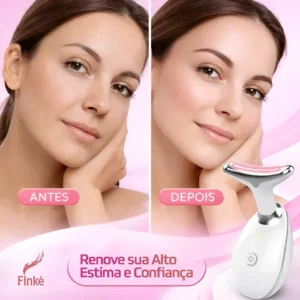 Massageador Facial Led Anti Rugas Lift Fototerapia 7 - Imagem 5
