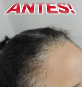 Shampoo Cation Preto Ou Castanho 400ml - Cobre Fios Brancos - Imagem 9