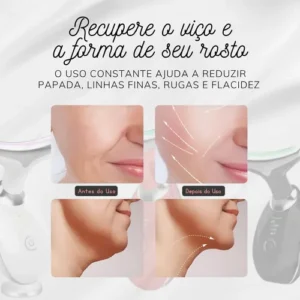 Aparelho Tratamento Facial Lift Anti Rugas Rejuvenescedor - Imagem 10